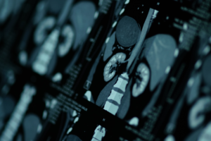 Digitail is compatible with preclinical imaging blog